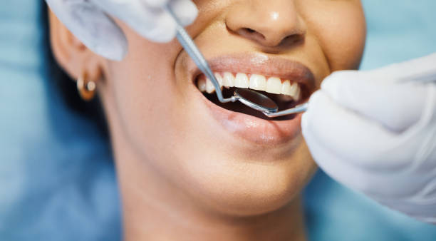 Best Emergency Treatment for Toothache in Bellows Falls, VT